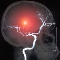 BrainIssue BrainIssue