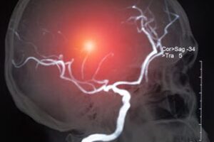 BrainIssue BrainIssue